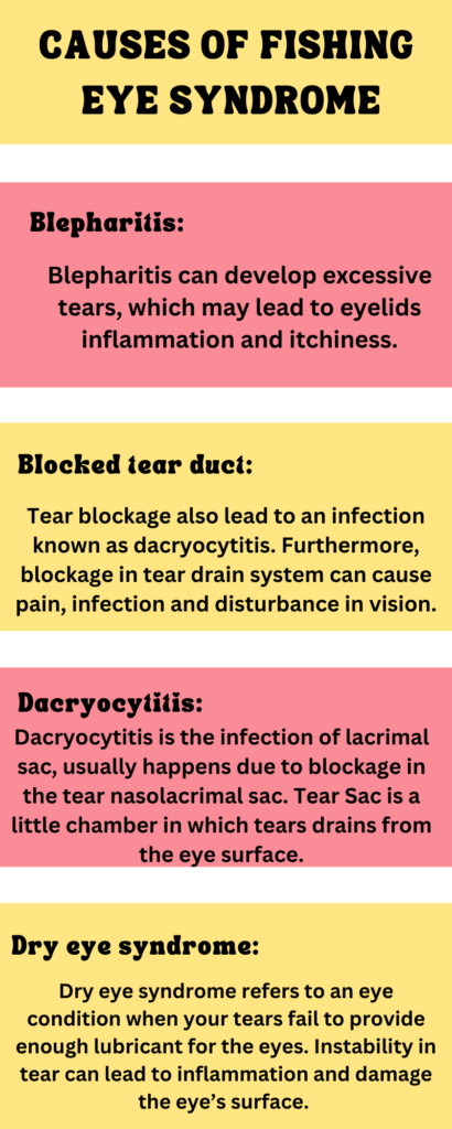 What Is Fishing Eye Syndrome